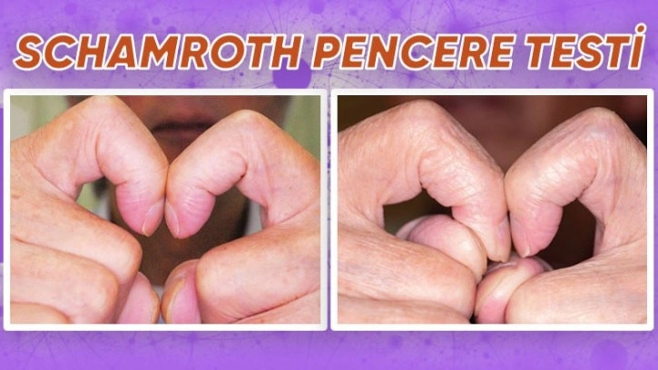Bu Parmak Testiyle Bazı Hastalıkları Teşhis Edebilirsiniz! - Webtekno