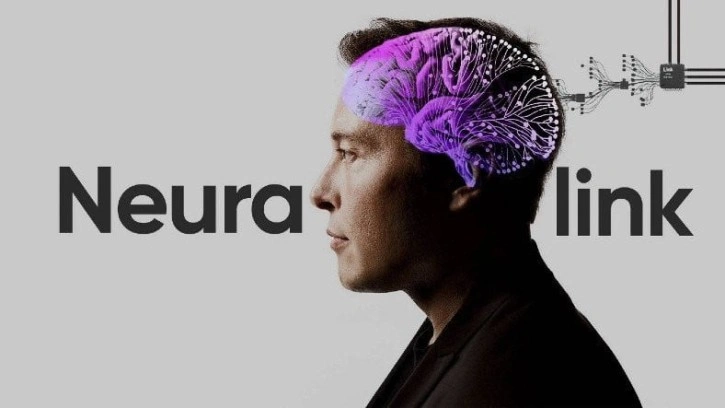 Elon Musk'ın Beyne Çip Takma Projesi Neuralink, Sonuç Verdi