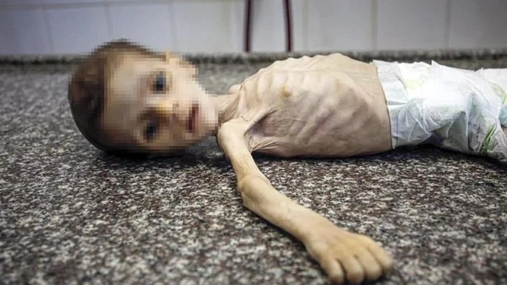 Gazze'de açlıktan ölen çocuk sayısı arttı! En küçüğü 14 günlük