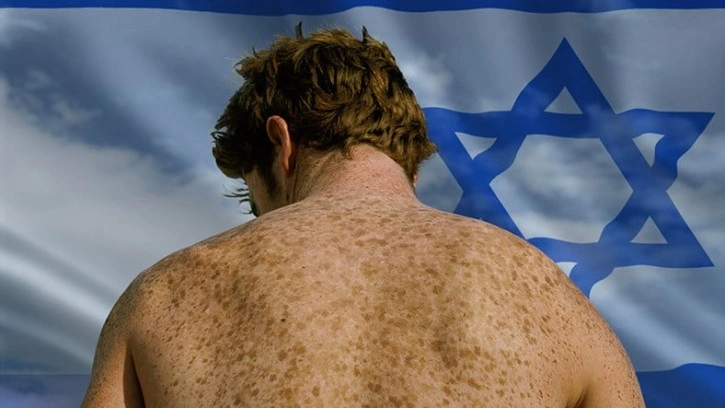 İsrailliler Cilt Kanserine Neden Daha Sık Yakalanır? - Webtekno