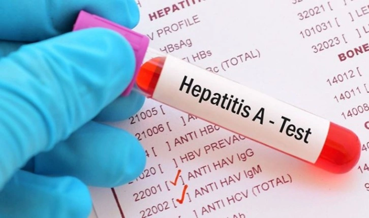 Uzmanından 'hepatit' uyarısı: '1998'den önce doğanlar mutlaka test yaptırsın