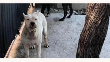 Adana'da pitbull cinsi köpeğin saldırısına uğrayan kız çocuğu yaralandı