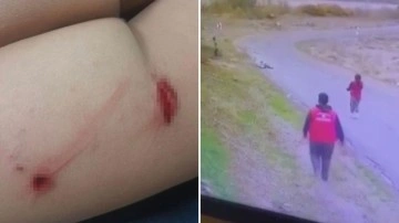 Ankara'da bisiklet süren çocuğa başıboş köpek saldırdı!