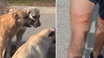 Başıboş köpekler okul bahçesinde öğretmene saldırarak yaraladı