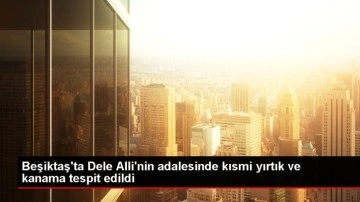 Beşiktaş'ta Dele Alli'nin adalesinde kısmi yırtık ve kanama tespit edildi