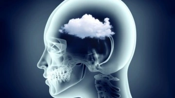 Beyin sisi nedir, belirtileri neler? Korona olanlarda mı oluyor, tedavisi var mı, nasıl?