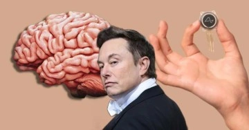 Bilim kurgu filmi değil gerçek: Elon Musk insan beynine çip taktı!