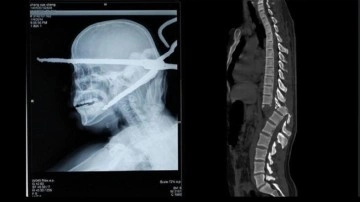 Birbirinden İlginç ve Rahatsız Edici Röntgen Görüntüleri