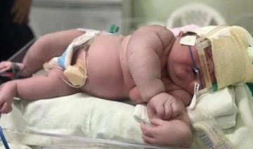 Brezilya'da 59 santimetre ve 7 kilo ağırlığında bir bebek dünyaya geldi