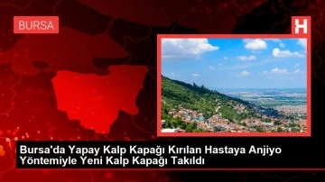 Bursa'da Yapay Kalp Kapağı Kırılan Hastaya Anjiyo Yöntemiyle Yeni Kalp Kapağı Takıldı