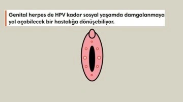 Cinsel Yolla Bulaşan HSV Virüsü Hakkında Bilmeniz Gerekenler