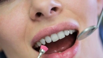 Dişinizi beyazlatmak isterken diş kaybına sebep olabilirsiniz!