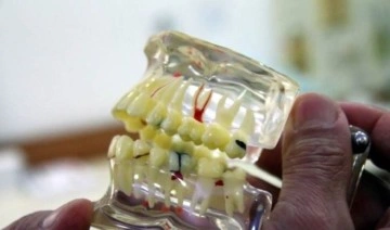 Erzincan’da sahte diş hekimi 10 kişiyi dolandırdı