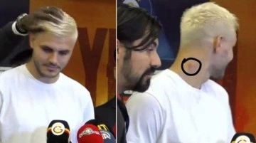 Galatasaraylı futbolcu Icardı'nin boynundaki morluk maç sonuna damga vurdu
