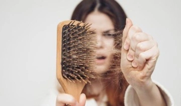 'Günde 100’den fazla saç teli dökülüyorsa muayene gerek'