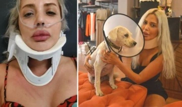 İddia: Köpek havlamasından rahatsız oldu, hayvansever kadını darbetti