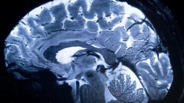 İnsan Beyninin En Net MRI Tarama Görüntüleri Çekildi