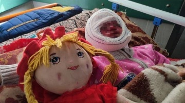 İsrail’in saldırılarında yüzü yanan 4 yaşındaki Seca, tedavi için bekliyor