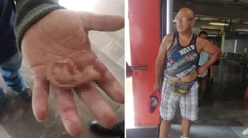 Kadının taciz iddiası metroyu karıştırdı! Kavga edenlerden birinin kulağı koptu