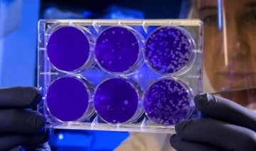 Kanserle savaşta yeni yöntem: Genetiği değiştirilmiş bakteriler