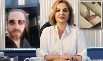 Kapısına 'dana dili' bırakılmıştı: Esin Davutoğlu Şenol'u tehdit eden kişinin ifadesi