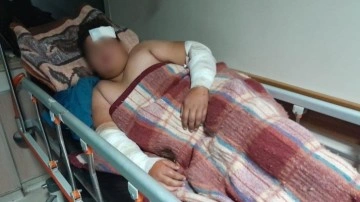 Konya'da köpeklerin kovaladığı çocuk bisikletten düşüp yaralandı!