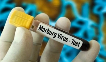 Körfez ülkelerinden 'Marburg virüsü' uyarısı