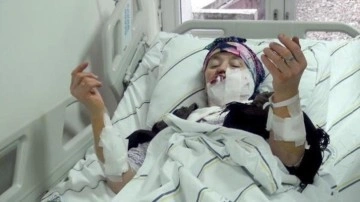 Kurdun saldırısına uğrayan kadının yüzü ameliyatla onarıldı
