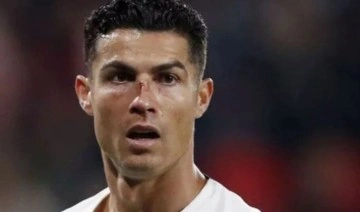 Maçta korkutan anlar: Ronaldo kanlar içinde yerde kaldı!