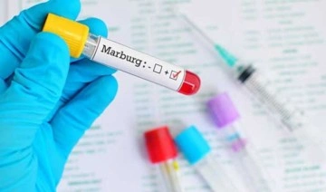 Marburg virüsü nedir? Marburg virüsünün belirtileri nelerdir? Marburg virüsü nasıl bulaşır?