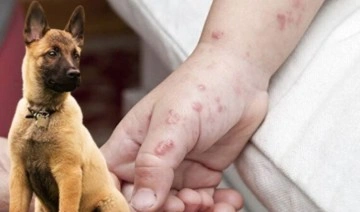 Maymun çiçeği virüsü endişelendiriyor: İlk kez insandan köpeğe geçti