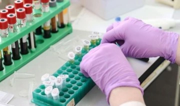 Moleküler testler kanser tedavisinde mutlak yer almalı