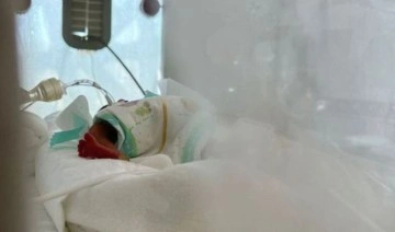Mucize gerçek oldu: 320 gram doğan bebek 5 ay sonra annesinin kollarında
