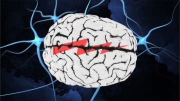 Nöroloji Nedir, Hangi Hastalıklara Bakar?