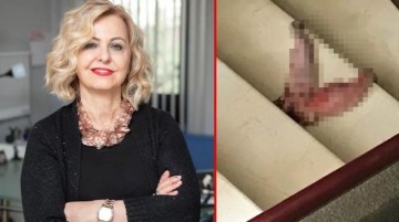 Prof. Dr. Esin Davutoğlu Şenol sosyal medyadan feryat etti: Kapıma dana dili bırakıp, öldürmek için