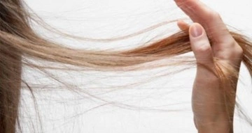 Saç dökülmesi neden olur? Saç dökülmesinin tedavisi nedir?