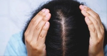 Saçta kepek neden olur? Saçtaki kepek nasıl geçer, tedavi yöntemleri nelerdir, evde ne yapılabilir?