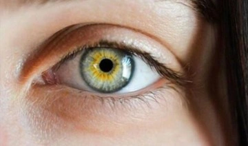 “Sarı nokta hastalığında kullanılan yeni cihaz ile görme seviyesinde iyileşme sağlanabiliyor”