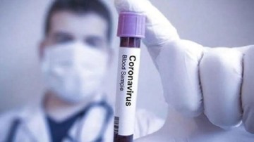 Son dakika haberi! Araştırma: Midkin protein seviyesi koronavirüsün yeni belirtisi olabilir