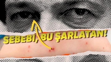Türkiye'de Kızamık Salgını Neden Yeniden Hortladı? - Webtekno