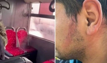 Ümraniye’de İETT otobüsünün klima borusu patladı, bir yolcunun yüzü yandı