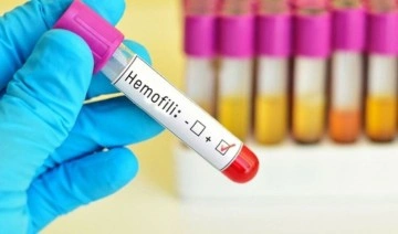 Uzmanı uyardı: 'Hemofilide sürecin yönetimi çok önemli'