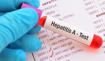 Uzmanından 'hepatit' uyarısı: '1998'den önce doğanlar mutlaka test yaptırsın&#03