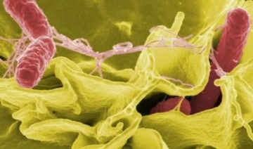 Uzmanından salmonella bakterisine ilişkin uyarılar