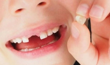 Uzmanından uyarı: Çocuklukta fark edilmeyen ağız ve diş yaralanmaları ileriyi etkileyebilir