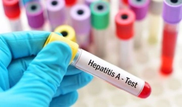 Uzmanlar uyarıyor, hepatite dikkat: 2 dakikada 1 kişiyi öldürüyor!