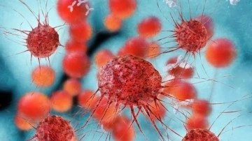 Yeni Yüksek Riskli Bir Kanser Tipi Keşfedildi